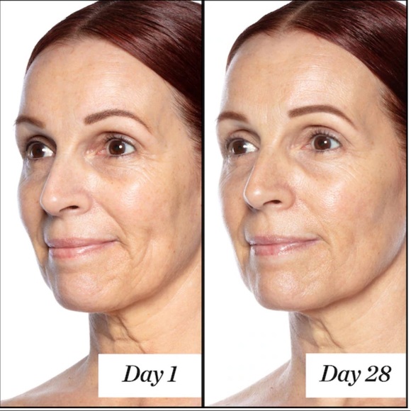 🌿SUNDAY RILEY Good Genes All-In-One Lactic Acid - Picture 8 of 11